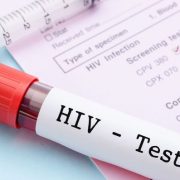 hiv test 3