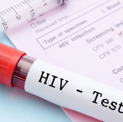 hiv test 3
