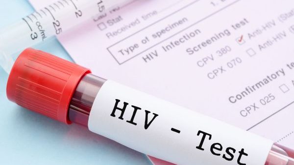 hiv test 3