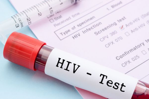 hiv test 3